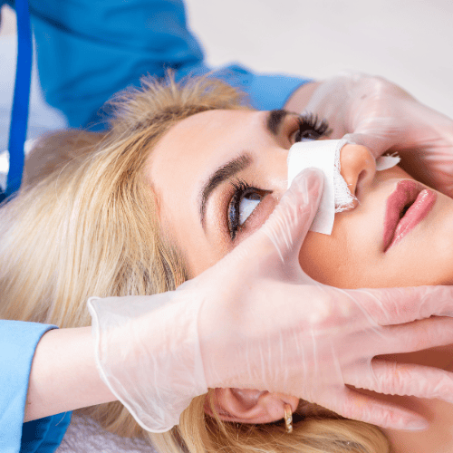 Picture of someone with a nose splint after surgery