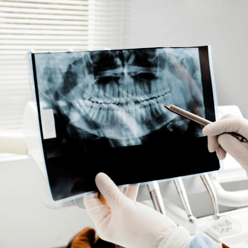 Picture of a panoramic radiograph