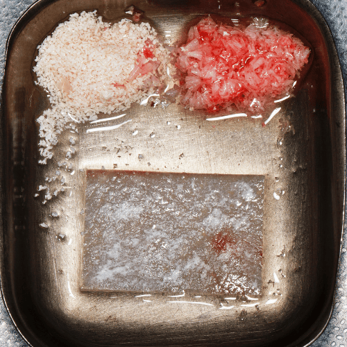 Picture of a bone graft