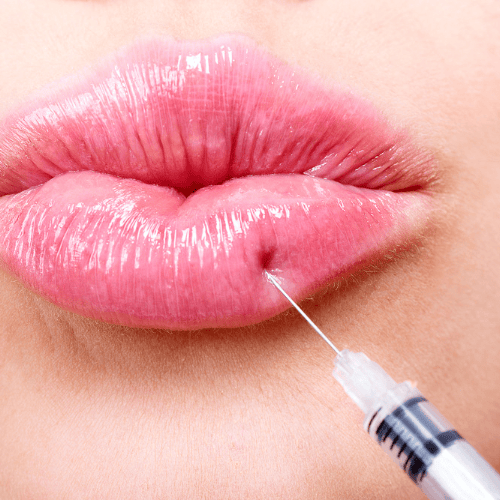 Picture of lip filler