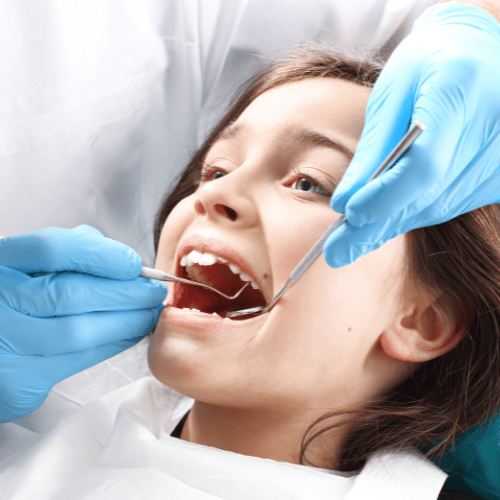 Dental Sealants